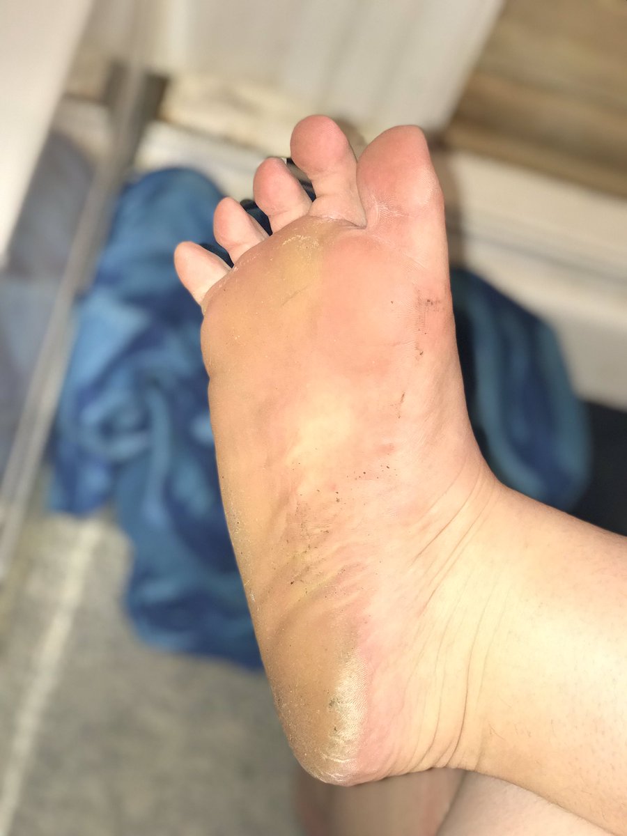 🤑 Goddess Riss 😵‍💫 on Twitter "Dirt on my feet from wearing my crocs