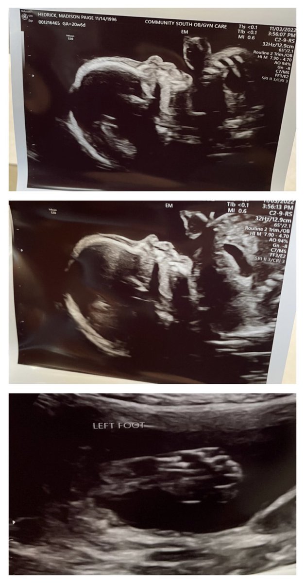 madisonhedrick_'s tweet photo. We love you so much already 🥹 https://t.co/tjcU8N2Z5W