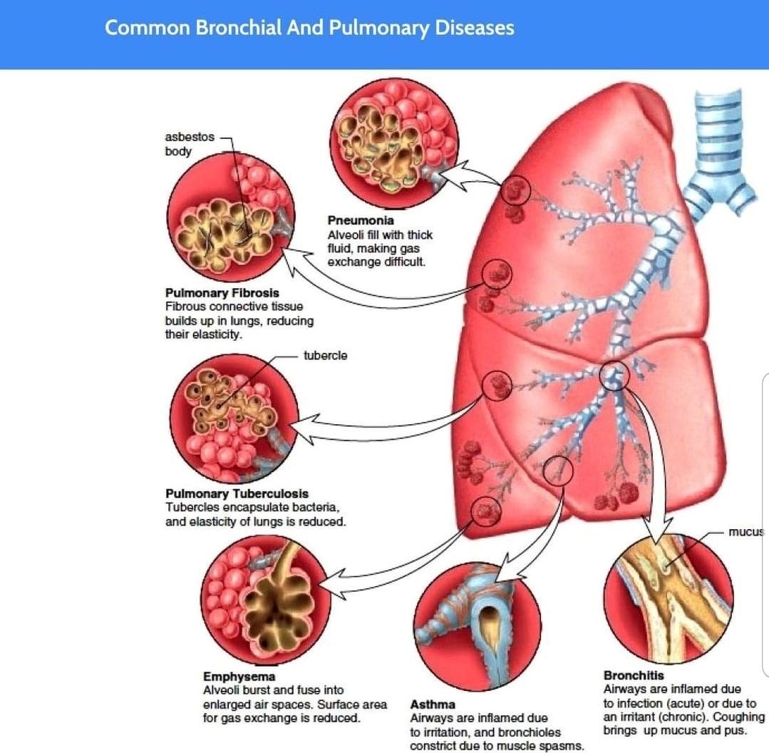 medictests's tweet photo. https://t.co/IzH10VpG9d