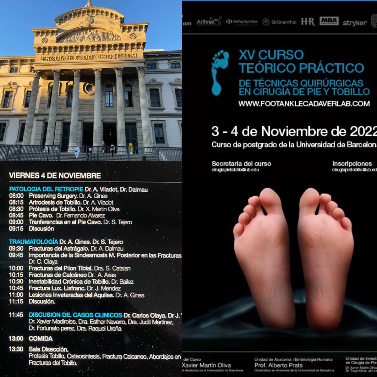 Hoy en la <a href="/UniBarcelona/">Universitat de Barcelona</a>  participando en el XV CURSO
TEÓRICO PRÁCTICO
DE TÉCNICAS QUIRÚRGICAS