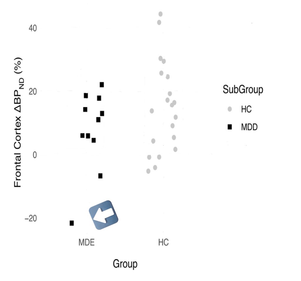 New paper claims to provide “clear evidence” for the serotonin hypothesis of #depression. 
N = 37, p = 0.04, and in the results you can see that removing a single observation turns the result non significant.