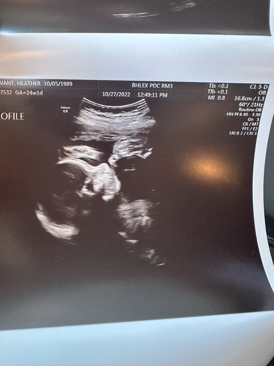 sturdy1589's tweet photo. I cannot wait to meet the love of our livesโฆ.#15weekstogo #KoryFaye https://t.co/8AuUmzzXen