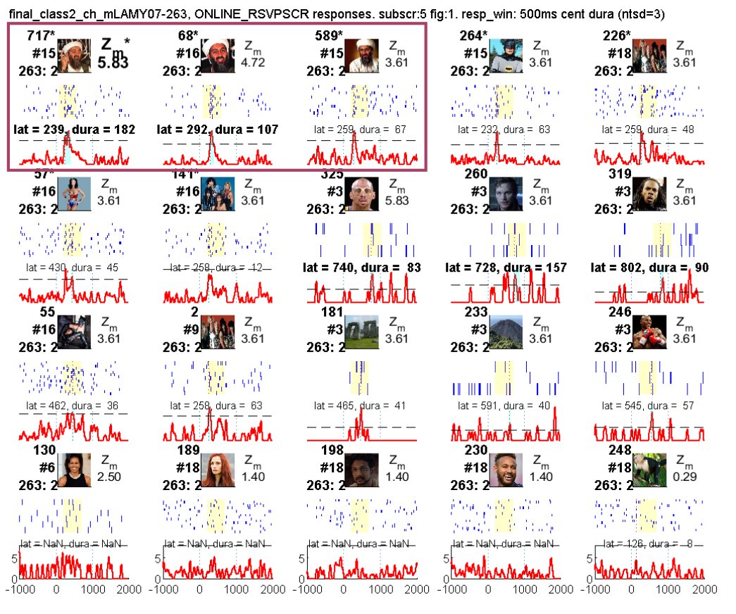 And the cherry on the top is that our new kernel for online dynamic experimental paradigms is up and running. We identified a neuron responding to a picture of Bin Laden and then were able to show on the fly other pictures to evaluate the response of the same neuron.