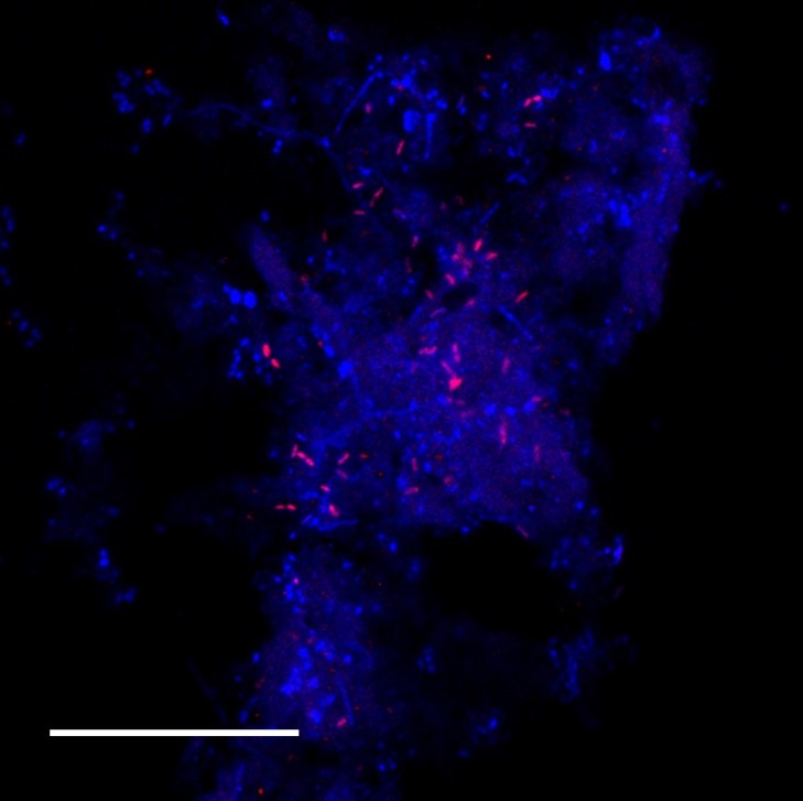 UQ ACWEB (@uqwater) on Twitter photo Taking a bite out of climate change - a propane-eating microbe has been discovered. University of Queensland researcher <a href="/gjhua316/">Jianhua Guo</a> says it could play a critical role in global climate change and air pollution control.
ow.ly/iEe650Lu05v Taking a bite out of climate change - a propane-eating microbe has been discovered. University of Queensland researcher <a href="/gjhua316/">Jianhua Guo</a> says it could play a critical role in global climate change and air pollution control.
ow.ly/iEe650Lu05v