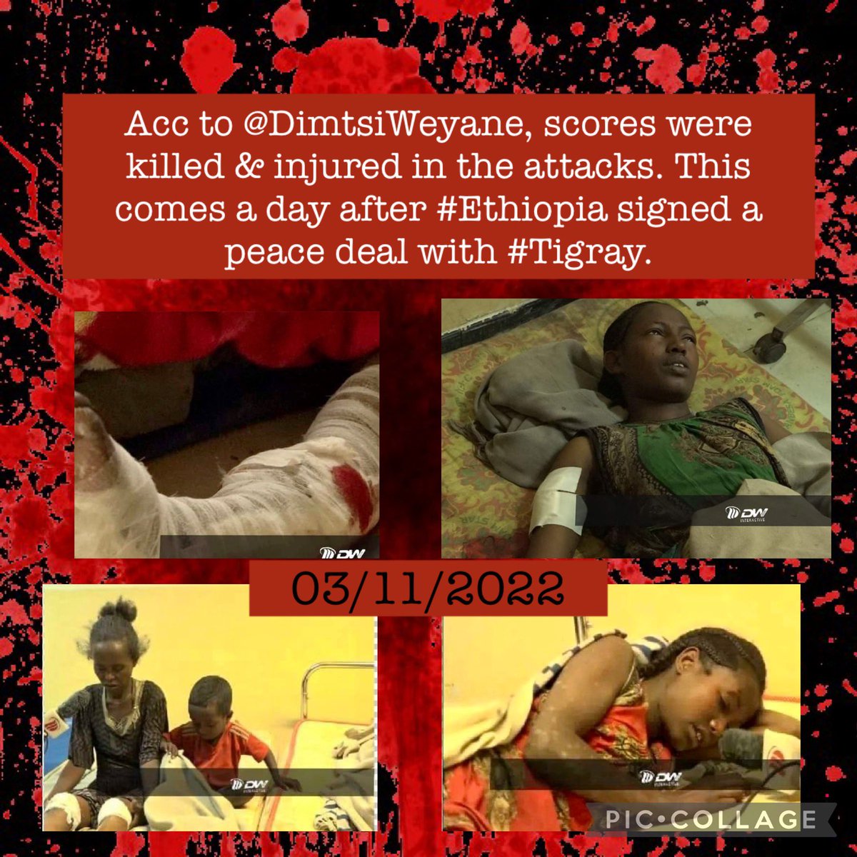 mrymmmd31133287's tweet photo. In less than 24hours of the peace deal,Ethiopia broke the agreement already &had a drone strike on #Maychew,#Entecho Cities& civilians were the victims again. When will the IC take action?#EndTigrayGenocide @POTUS @MikeHammerUSA @_AfricanUnion @StateDeptSpox @USAmbUN @SecBlinken https://t.co/uJIgBMEqRh