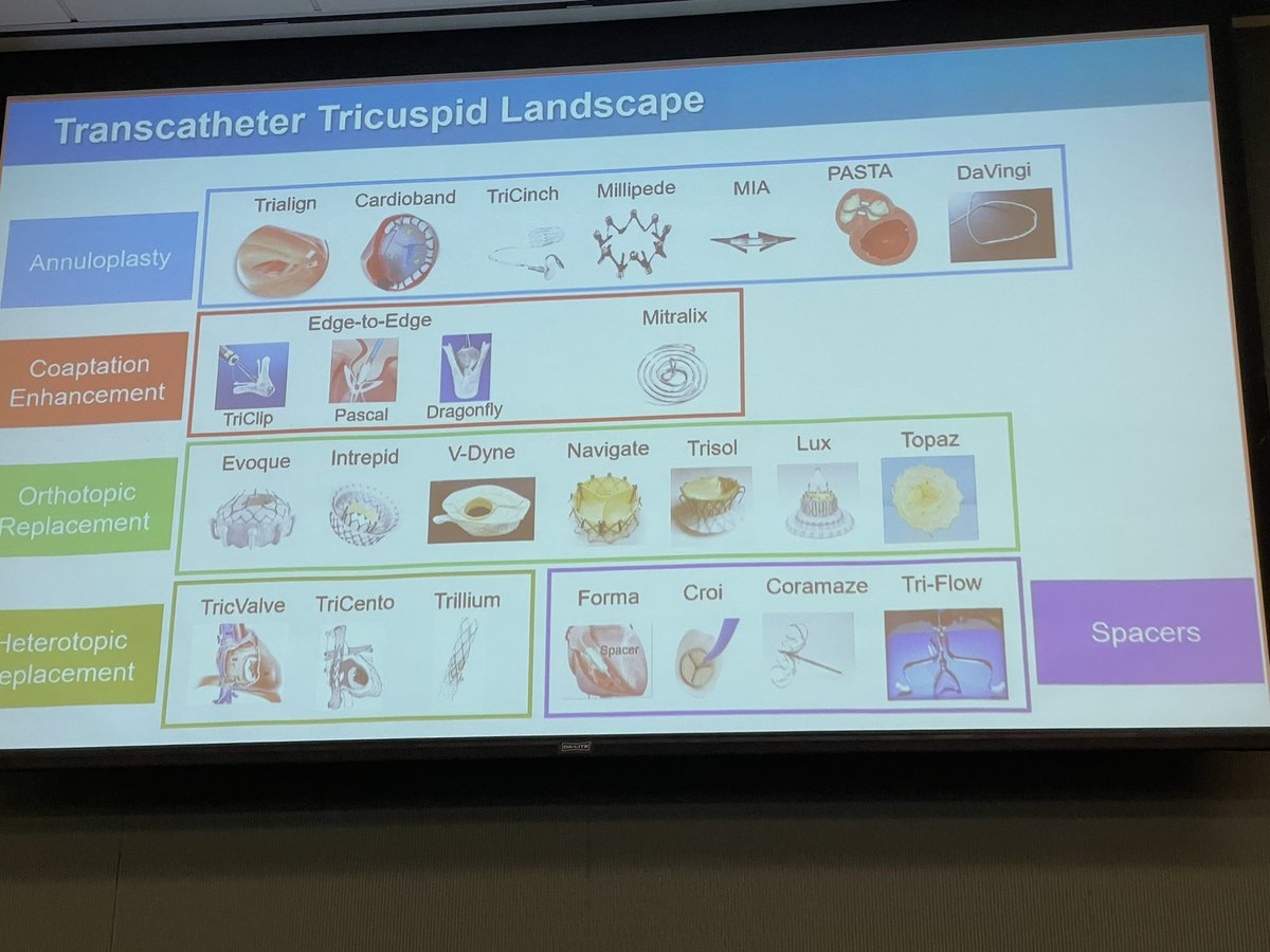 Mahazarin Ginwalla (@mahazaring) on Twitter photo Amazing grand rounds by <a href="/SpiesMd/">Christian Spies MD</a> on Valvular Heart Disease <a href="/SutterHealth/">Sutter Health</a>: Early referral is key! <a href="/DVDaniels/">Dave Daniels</a> <a href="/AxisDeviation/">Amir Schricker</a> <a href="/EPWoodsShop/">Christopher Woods</a> <a href="/ElliottMGroves/">Elliott M Groves</a> Amazing grand rounds by <a href="/SpiesMd/">Christian Spies MD</a> on Valvular Heart Disease <a href="/SutterHealth/">Sutter Health</a>: Early referral is key! <a href="/DVDaniels/">Dave Daniels</a> <a href="/AxisDeviation/">Amir Schricker</a> <a href="/EPWoodsShop/">Christopher Woods</a> <a href="/ElliottMGroves/">Elliott M Groves</a>