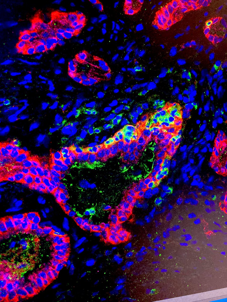I really love this part my job ❤️ #FluorescenceFriday #phdlife