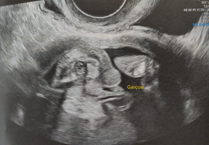 Dorya Wilk’s pics and videos