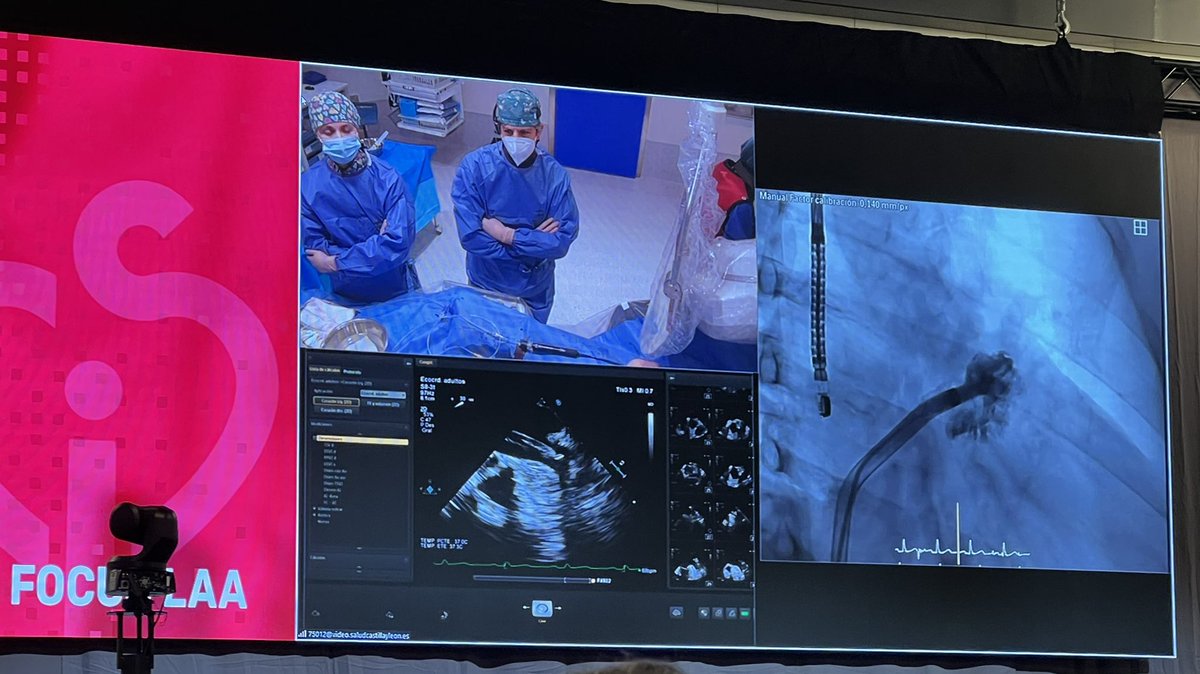 Ale_Gonzalez_Z's tweet photo. Congratulations @icruzgonzalez and @scardiosal for the live case during the @CSIcongress #CSIFocusLAA 👏👏👏👏👏👏👏👏👏👏👏👏👏 https://t.co/CinpSyAyaG