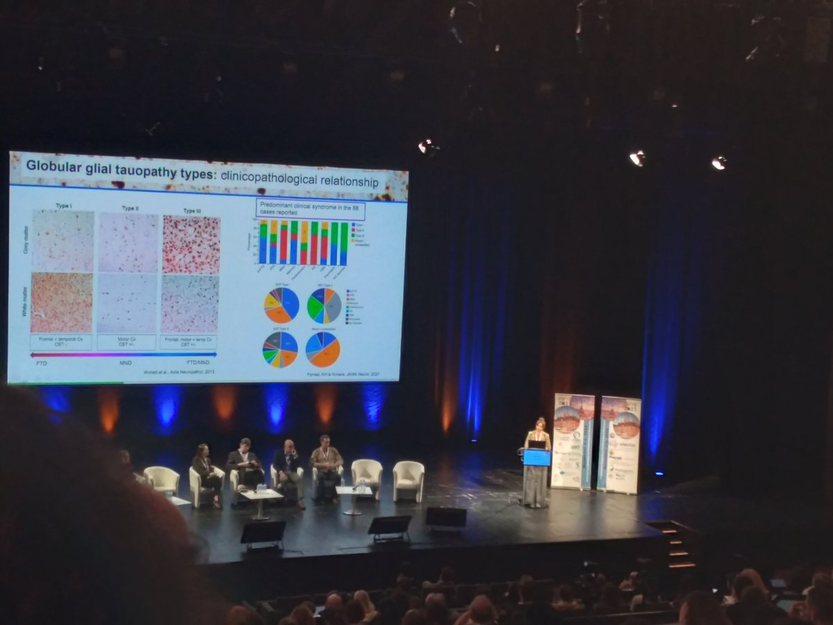 International Society for Frontotemporal Dementias (@isftd) on Twitter photo New <a href="/tanzuoft/">Tanz Centre at University of Toronto</a> trainee Shelley Forrest presents on co-existing proteinopathies in globular global #tauopathy w/ some data from the recently established #GGTconsortium New <a href="/tanzuoft/">Tanz Centre at University of Toronto</a> trainee Shelley Forrest presents on co-existing proteinopathies in globular global #tauopathy w/ some data from the recently established #GGTconsortium