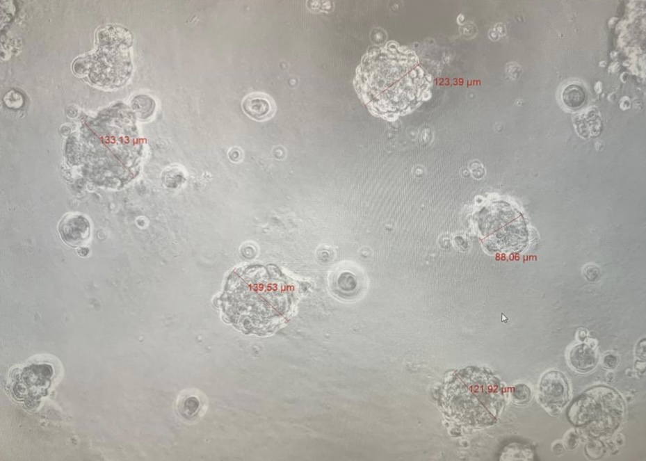 3D cellular models (spheroids of breast cancer cells) are ready to test the anti-tumour activity of our compounds 👏👏👏
Many thanks to Jess Castro for her help and expertise!