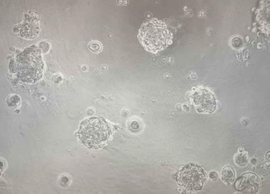 TatUdg's tweet photo. 3D cellular models (spheroids of breast cancer cells) are ready to test the anti-tumour activity of our compounds 👏👏👏
Many thanks to Jess Castro for her help and expertise! https://t.co/vRHSpEczVi