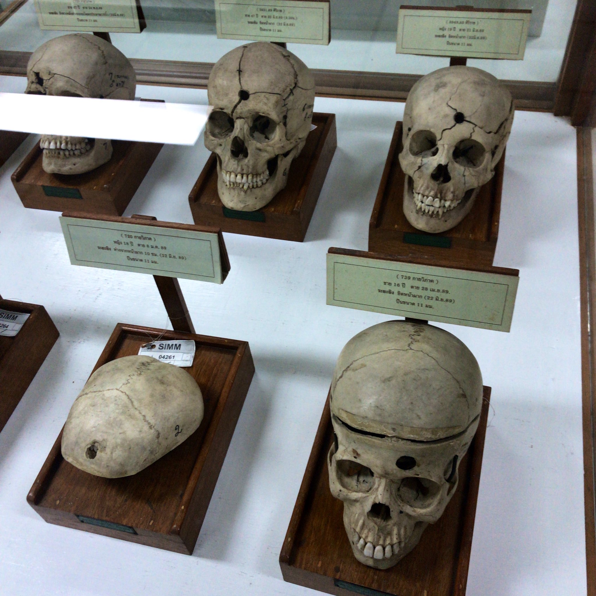 腐乱 死体達の博物館 銃弾で頭を撃ち抜かれた頭蓋骨 奇形児の展示 殺人に使われた道具の展示 どれもインパクトがすごかった T Co Aogcesexd5 Twitter