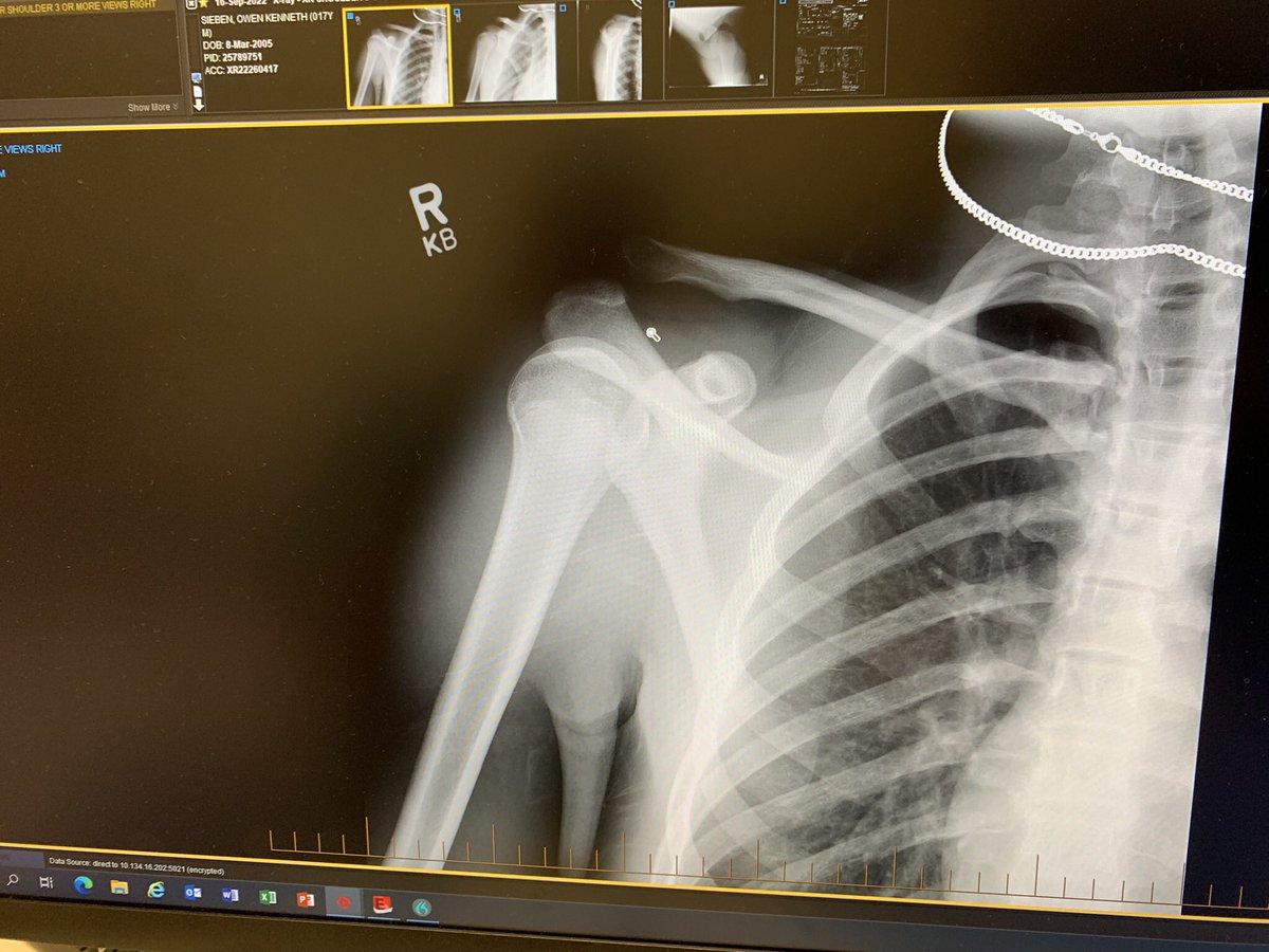 Owen Sieben tweet media