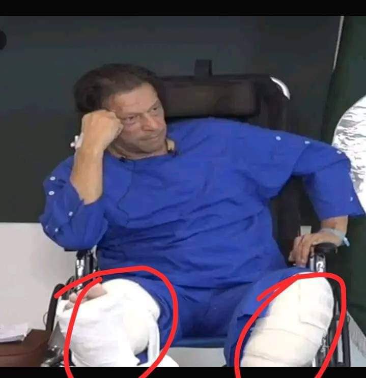 کل گولی ایک پیر میں لگی تھی اور پٹی بھی ایک پاؤں میں تھی آج میڈیا کے سامنے پٹی دوسرے پاؤں میں بھی ؟
تعجب ہے