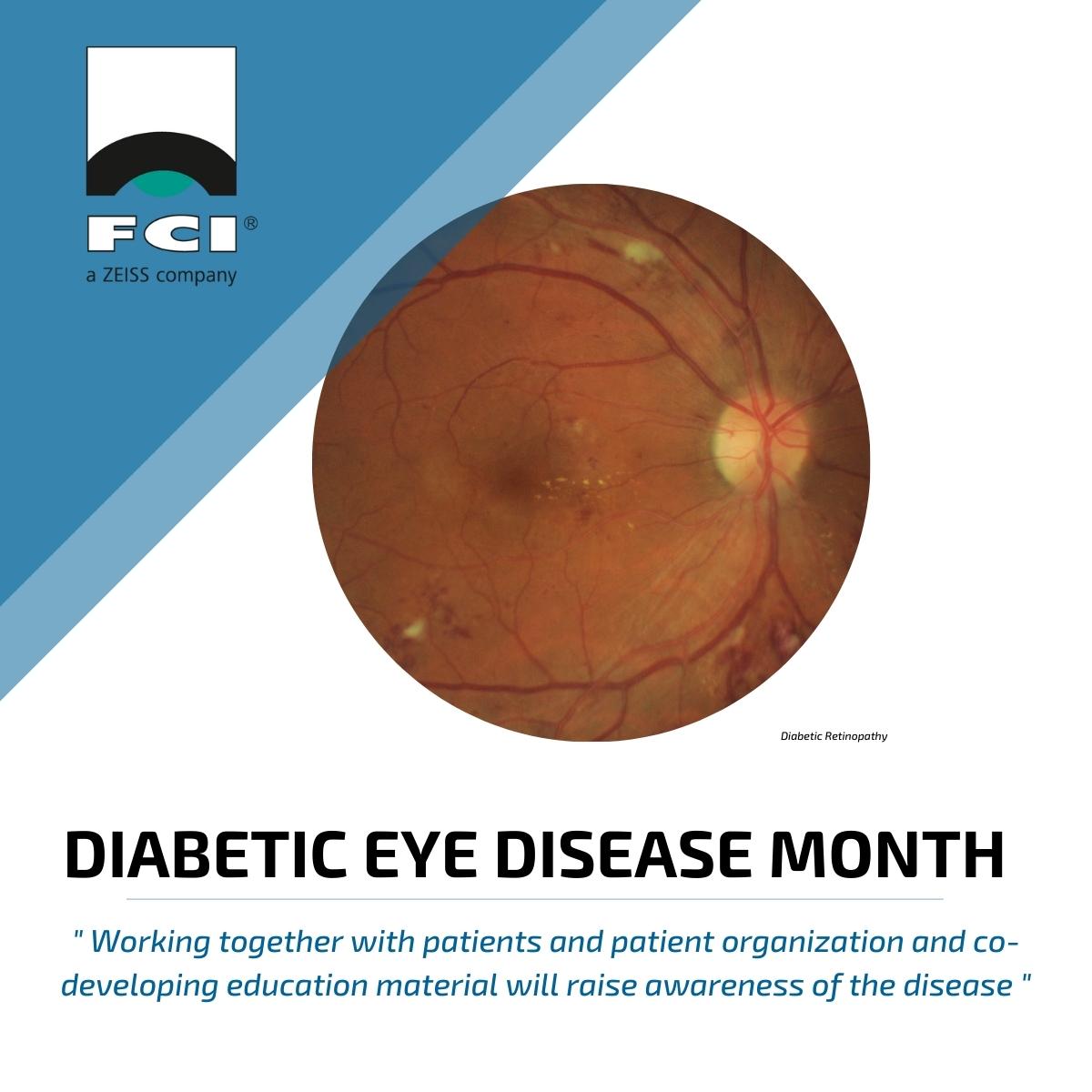 FCI Ophthalmics (FCI_Ophthalmics) / Twitter