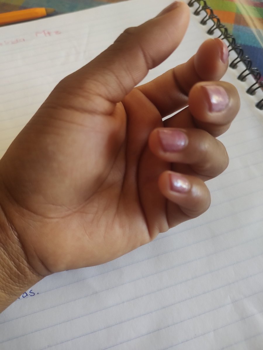 SoyCesi's tweet photo. No me gustan mis manos.
Pero hoy a finalizar una terapia un paciente me pidió que se las mostrara, me las tomó y agradeció por ellas.

🥰 https://t.co/LOvv5REtXG