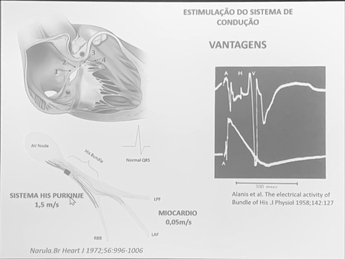 ManlioMarquez's tweet photo. #LAHRS2022 and #SOBRAC Congress. The beginning of His pacing with reference to first recording of His potential by Alanís 👌🏻 https://t.co/LJ8nM9Yiyp