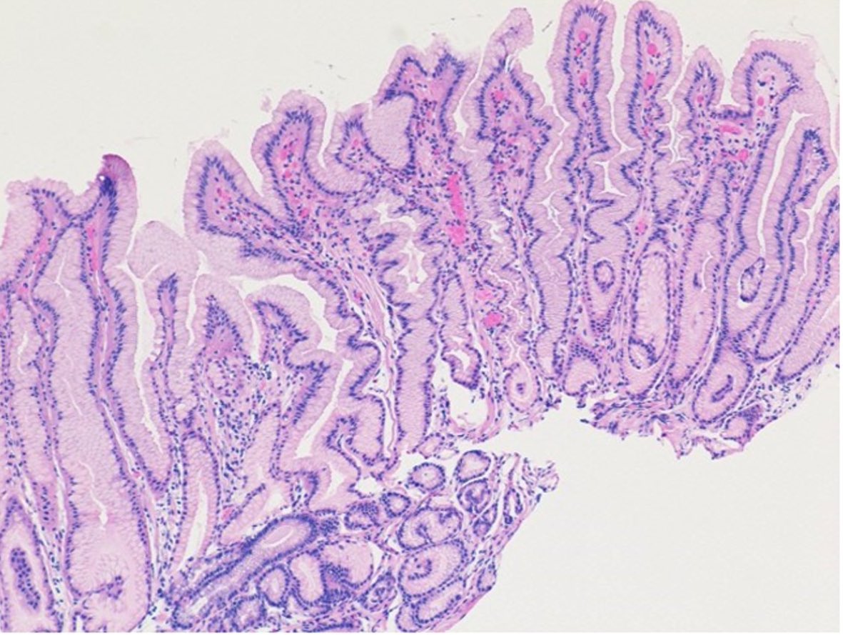 Rashmi Advani, MD, ABOM tweet media