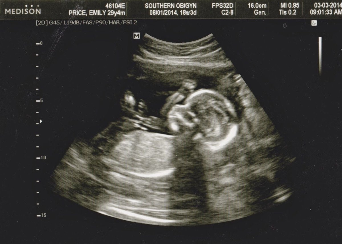 Hi! I’m Gabriella, but my friends call me Gabby. I’m 16 weeks old, and my mommy felt me kick for the first time today! I hope she knows I’ve been kicking up a storm in here for the last 9 weeks! She got pictures of me at the doctor yesterday. I made sure to wave for the picture!