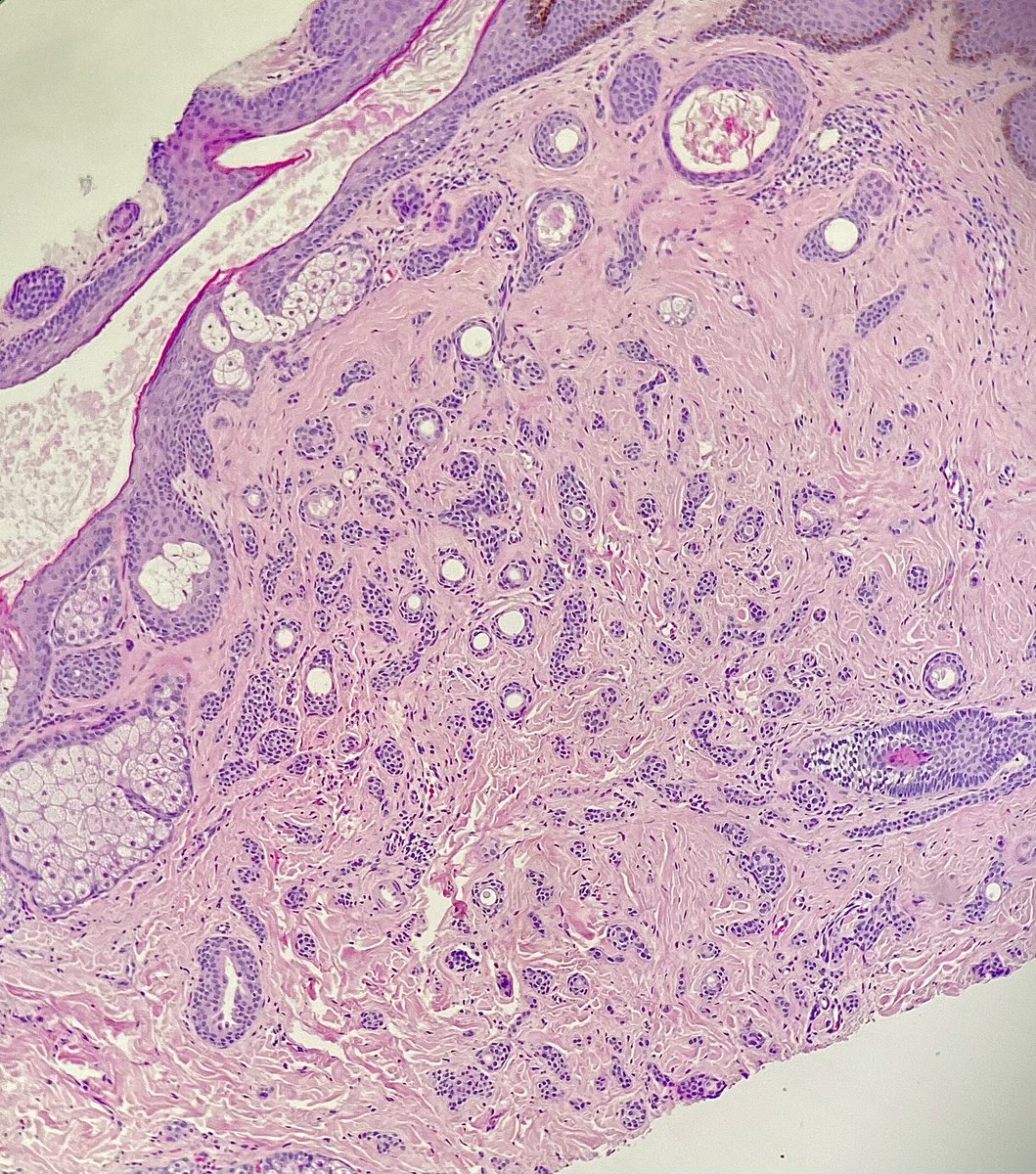 RT @Nate_path: I like listening to Brad ‘Paisley’ while I work…@JMGardnerMD #PathTwitter #dermpath https://t.co/R2ROKxwYUT