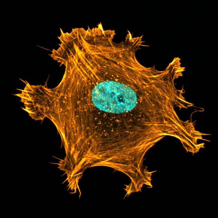 It's Funky Fibroblast Friday ™ #FluorescenceFriday  #sciencetwitter #academictwitter #STEMinist #STEM #Biology #WomeninSTEM #Microscopy #Microscope #CellBio #CellMigration