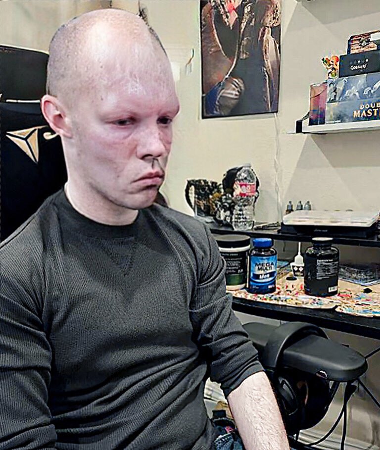 Brady’s health took a steep decline yesterday after someone in chat killed his Glaceon. Please pray for him