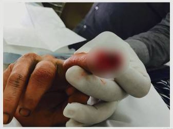 TallesPastro's tweet photo. Rihanna: VÍTIMA provada (Foi espancada e ficou assim)

Johnny Depp: VÍTIMA provada (Teve o dedo decepado, foi agredido e ficou assim)

Amber Heard: MENTIROSA provada e condenada (Disse que teve o nariz quebrado e apareceu assim) https://t.co/qDBCYkoenh