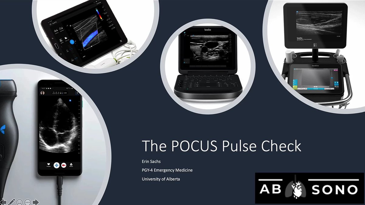 UAlberta_Sono's tweet photo. What is a POCUS pulse check? see here, as broken down by Dr. Erin Sachs, an all-star EM resident! @UofA_RC_EM @UAlberta_ICU @UAlberta_FoMD @STARSambulance 
https://t.co/THrYfPuj5x #POCUS #CCUS #SavingLivesWithSound @zedunow @iceman_ex https://t.co/NX1OYFcXEk