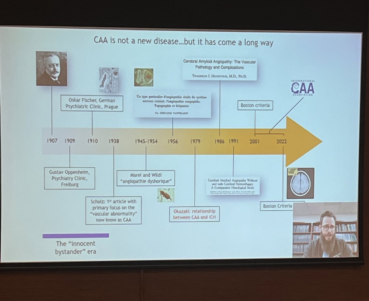 iCAA (@icaaassociation) on Twitter photo A great presentation by <a href="/a_charidimou/">Andreas Charidimou MD, PhD</a> on diagnostic perspectives in CAA! #iCAAPerth2022 A great presentation by <a href="/a_charidimou/">Andreas Charidimou MD, PhD</a> on diagnostic perspectives in CAA! #iCAAPerth2022