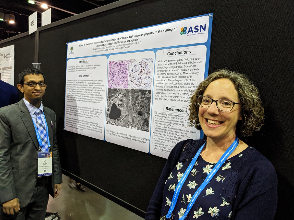 Catherine Moore (@cmoorenephmd) on Twitter photo So proud of Dr. Alom presenting not one but two posters yesterday... Could not get a great angle due to a crowd but this is a case of suspected renal-limited MAS. <a href="/UrmcNephrology/">URMC Nephrology</a> So proud of Dr. Alom presenting not one but two posters yesterday... Could not get a great angle due to a crowd but this is a case of suspected renal-limited MAS. <a href="/UrmcNephrology/">URMC Nephrology</a>