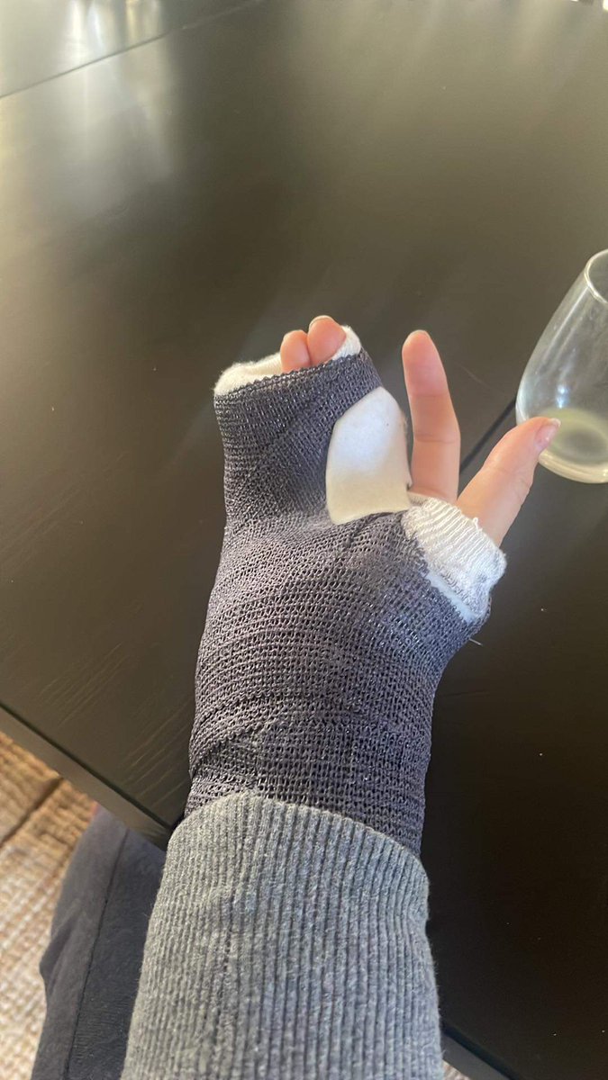 So far this CX season did not go according to plan 🙉 Yesterday I crashed at the course recon in Namur - and here's the result. No start in Europeans 🇪🇺 tomorrow - obviously.  First I got hit by Covid for weeks, now this....hoping for better days to come 😔