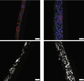 pulmonary_news's tweet photo. 🙌 Congratulations to Drs. Venkataramana Sidhaye (@sidhayelab), Baishakhi Ghosh (@bgosh226) & team at @HopkinsPCCM on their discovery of E-cadherin's causal role in the pathogenesis of #emphysema and airway dysfunction in #COPD.
More in @CommsBio!
👉 https://t.co/kBlF7ZpYOw https://t.co/tlumNxN2ed