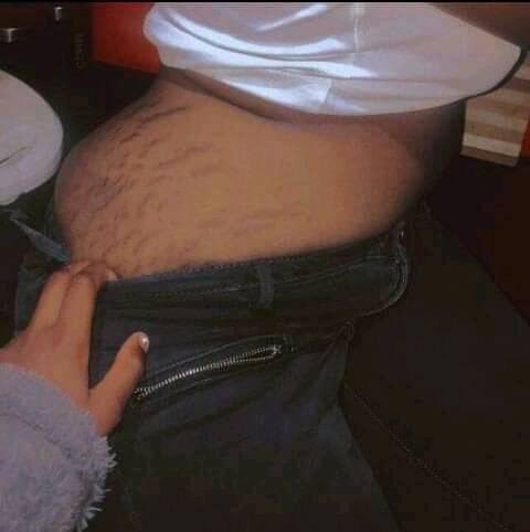 What do you know about girls with stretch marks?😂😂