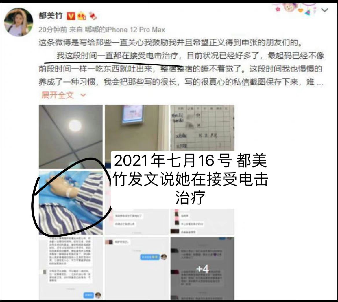 wuyifan_iranfan's tweet photo. On July 16th, 2021, Du Meizhu claimed she went under electroshock therapy because of her depression, but on February 27th, 2022 Liu Meili exposed her & revealed she got the plastic surgeon with the money she extorted from #KrisWu's mother!
#JusticeForKrisWu #FreeKrisWu https://t.co/Waqs84rRkr