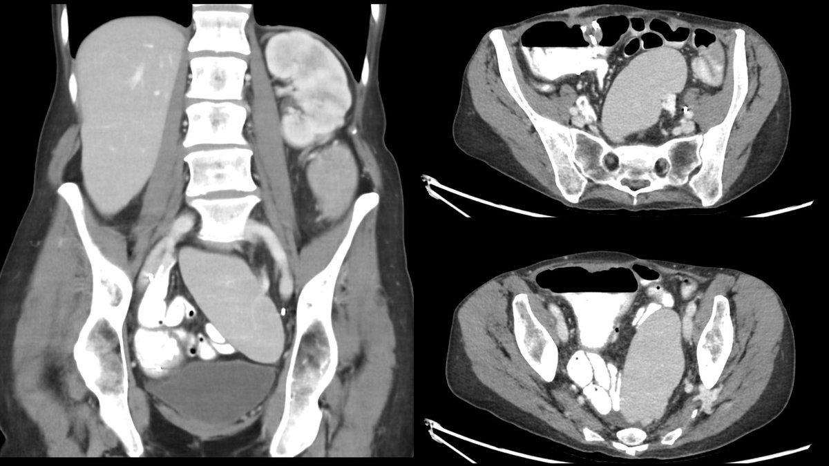 Daniel Souza tweet media
