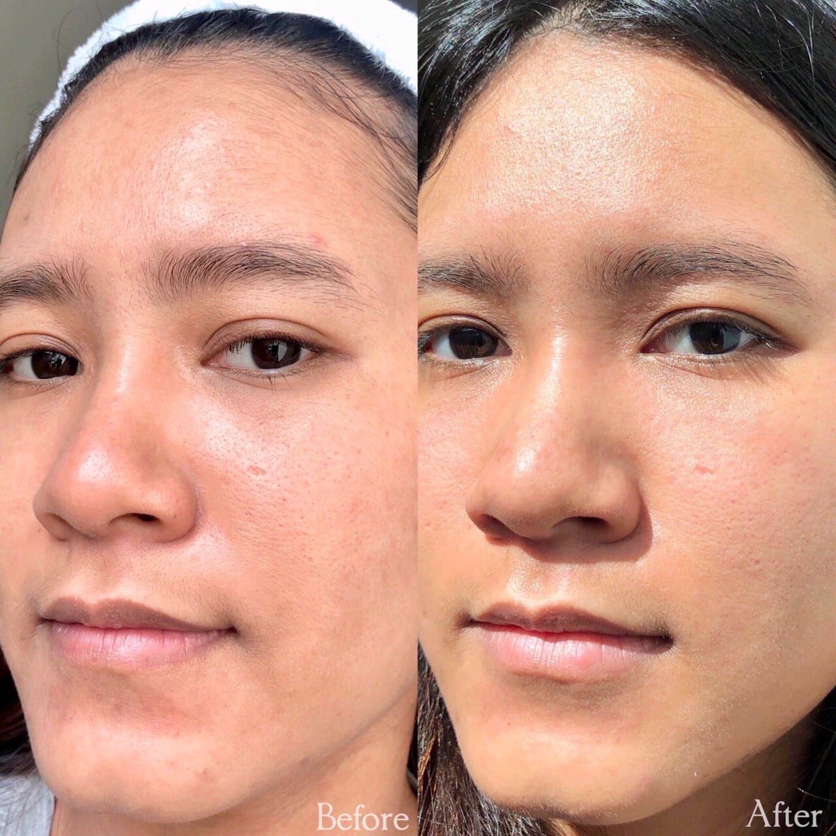punzel921's tweet photo. รีวิว VALANI Finol Cream เป็นแบรนด์ที่ผลิตโดยคุณหมอ เหมือนมีคุณหมอมาดูเเลจริงๆเลยย เพราะใช้สารสกัดที่ดีที่สุด ช่วยลดริ้วรอย จุดด่างดํา เพิ่มความชุ่มชื้นให้ผิว เนื้อครีมซึมไวไม่เหนอะหนะ ตอนนี้มีโปรโมชั่นด้วยย เหลือ 1,290 จาก 1,500 คุ้มมากก
#valani #valanifinolcream #ใช้ดีบอกต่อ https://t.co/qPiUmtGPiU