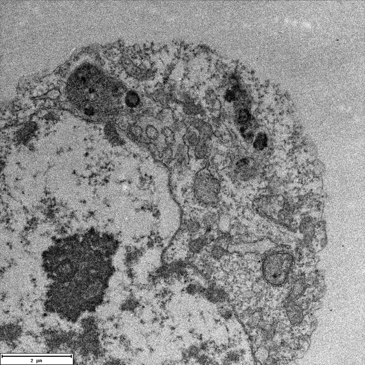 QUT_CIIC's tweet photo. @ScientiSTICA_84  In mosquitoes, #Wolbachia blocks #dengue virus transmission. We are using TEM to further investigate these intracellular interactions during coinfection https://t.co/xWwtHGMHt0 https://t.co/7QGV0wUo9F