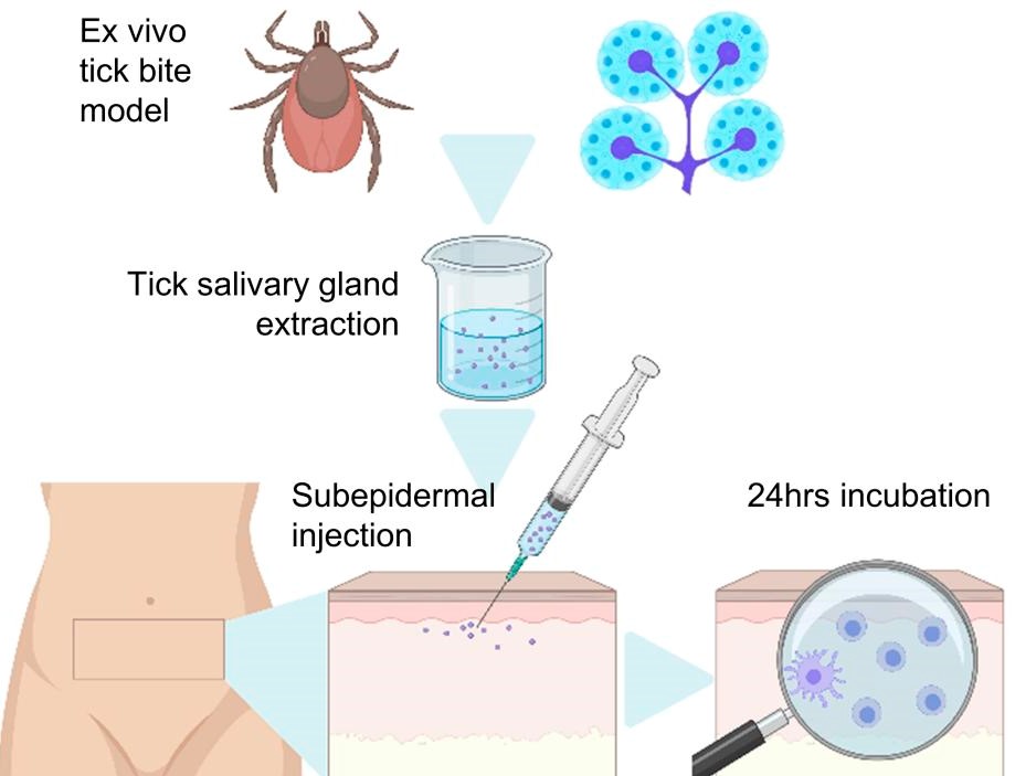 ImmunoEditor's tweet image. My Editor&apos;s Choice in @ScienceMagazine highlights work in @jclinicalinvest by @johanna_strobl, @StaryGeorg &amp;amp; al. Authors describe effects of #tick bites on #ImmuneSystem &amp;amp; develop an ex vivo model of #LymeDisease! 

EC: bit.ly/EC221118
Article: bit.ly/3USYkbR
