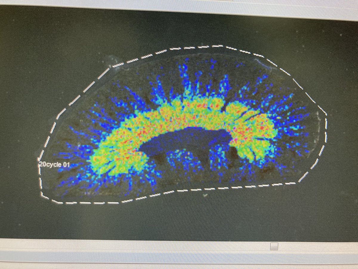 ThomasKYLAM1's tweet image. My first MS imaging 🥰🥰
#spatialmetabolomics #imagingms
