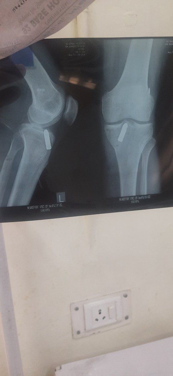 Sandy95275's tweet photo. @ACLrecoveryCLUB https://t.co/EEeQUo6E3j