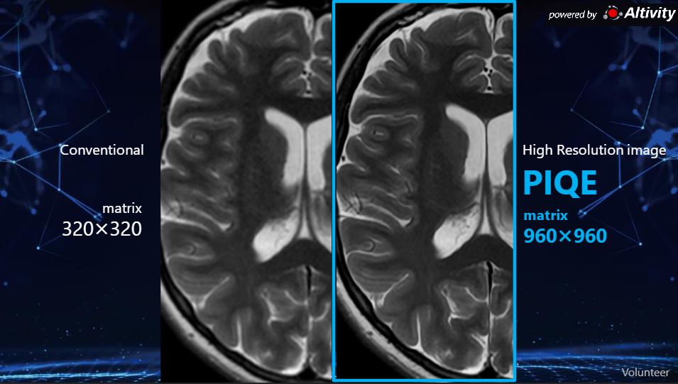 CanonMedical's tweet photo. Introducing Canon’s next generation of re-imagined workflow, with clever imaging solutions that are powered by #Altivity. Headlined by PIQE, a technology that increases matrix size, removes noise, and delivers sharp anatomical images.

Visit https://t.co/DwYtBvE51U https://t.co/I9fV2mfekh