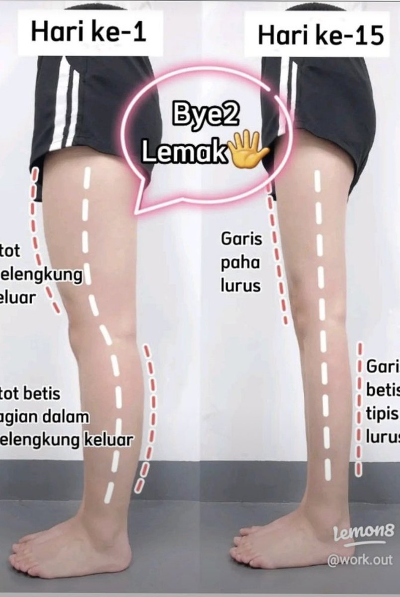 putrecommended's tweet image. Tips mengecilkan paha dan betis✨

by Lemon8