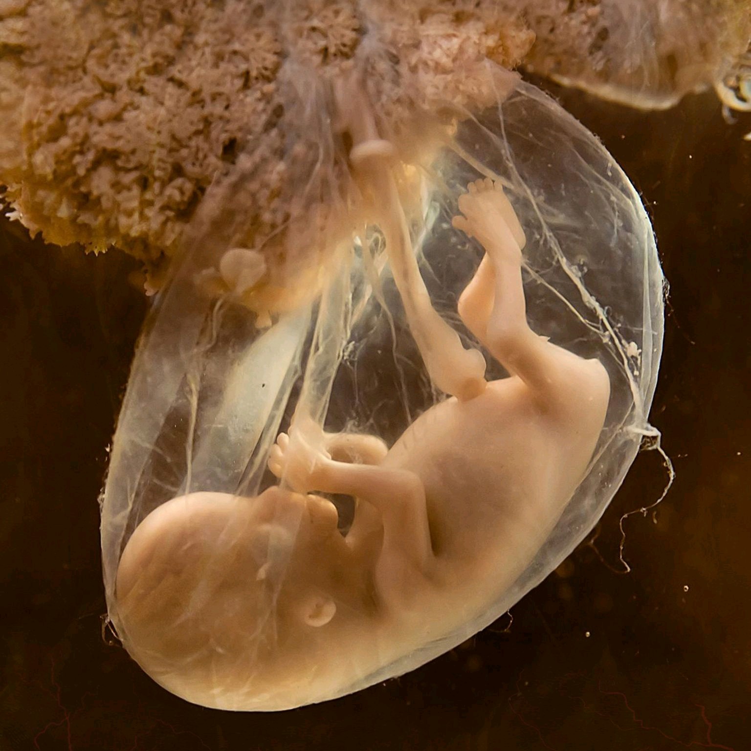 фото по неделям расположение плода