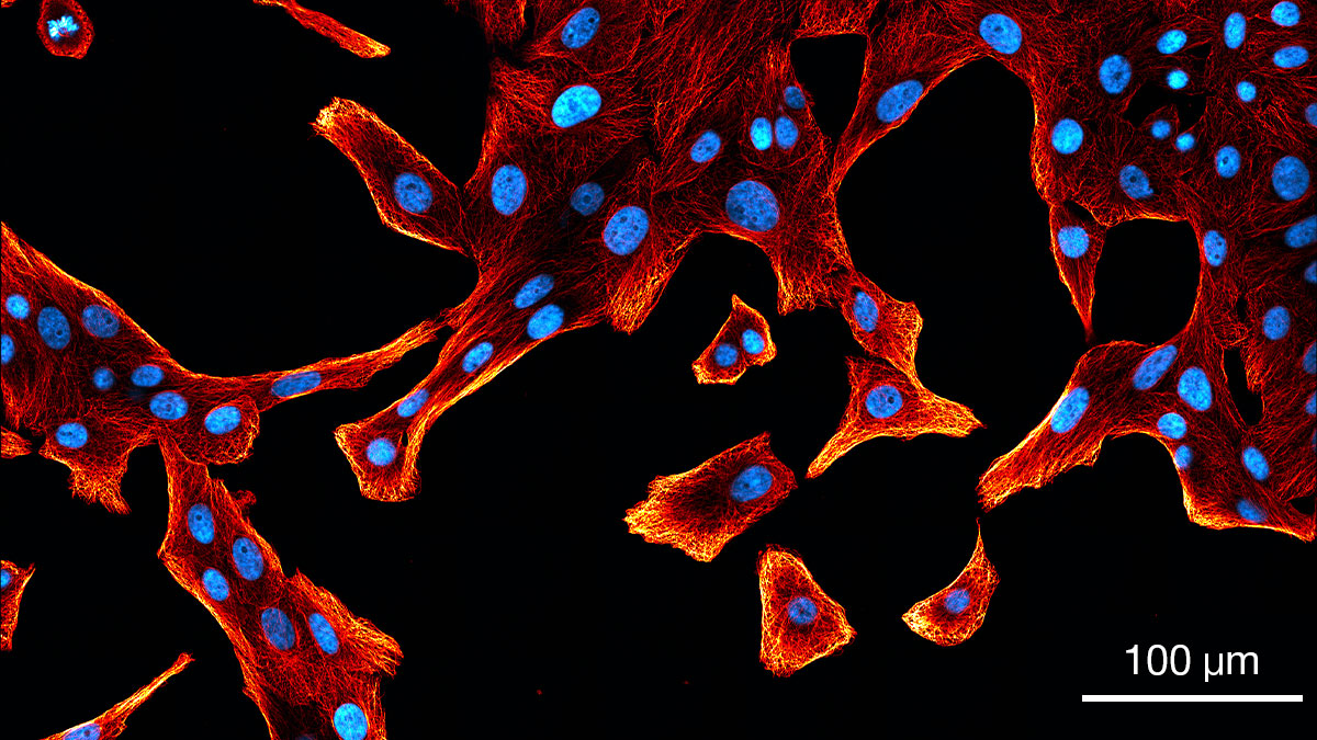 Abberior's tweet image. Discover the whole sample! For #FluorescenceFriday a large field of view showing tubulin filaments stained with #abberior STAR GREEN & the nucleus with #DAPI #Confocal images were acquired with our #STEDYCON & stitched using @svi_huygens
#imaging #microscopy #biology #fluorophore