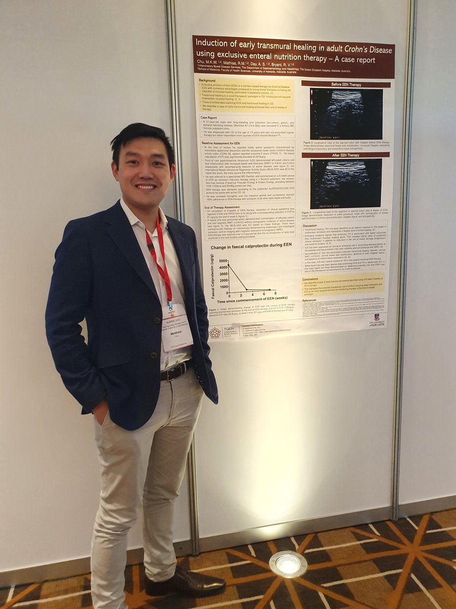 Alice_APD's tweet photo. Early transmural healing (IUS) with EEN therapy in active Crohn's disease #drmatthewchu #Crohns
#IBD #EEN @ADL_IBD https://t.co/ytgzbQqOmA