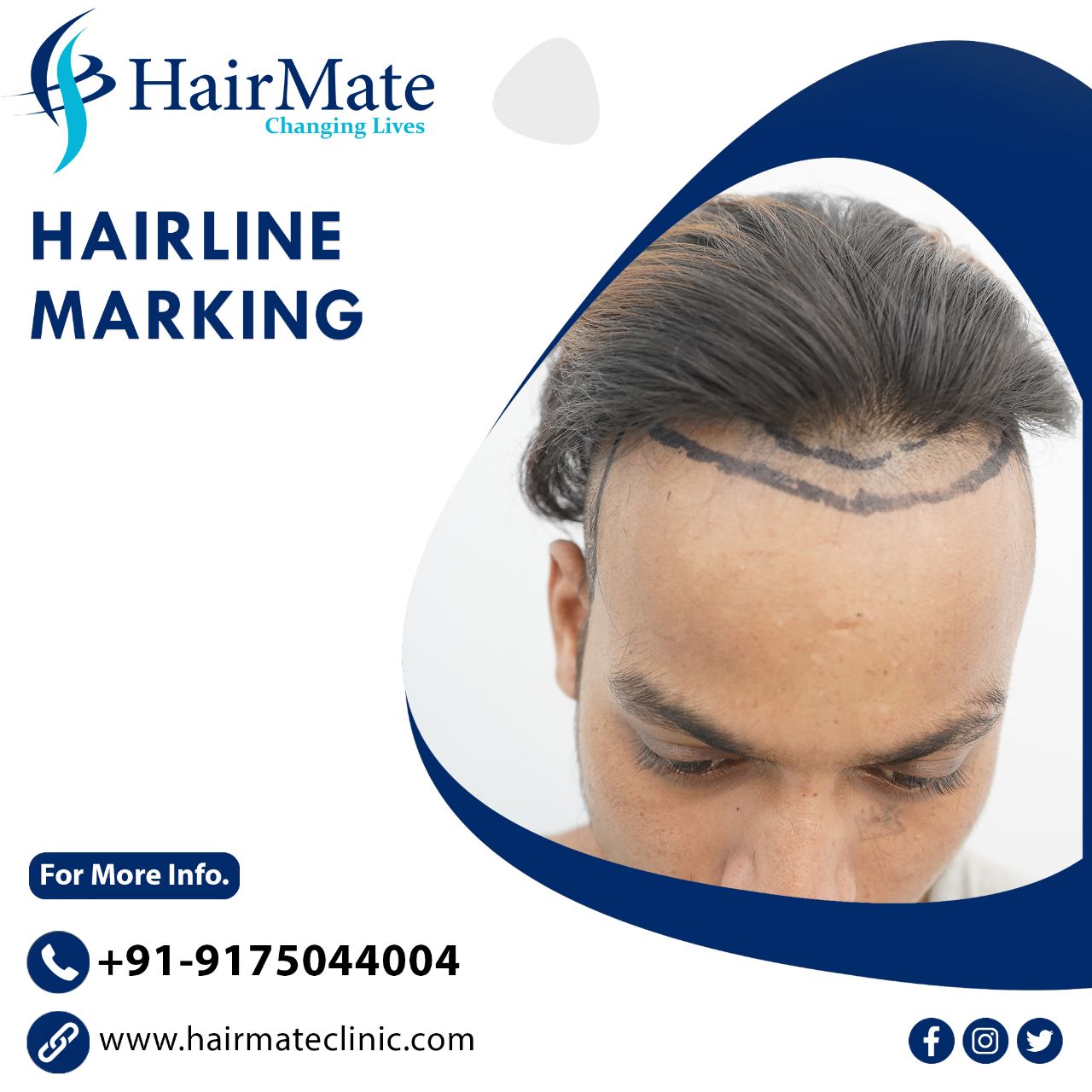 Hair Mate Clinic on Twitter: Hair Mate Clinic on Twitter: