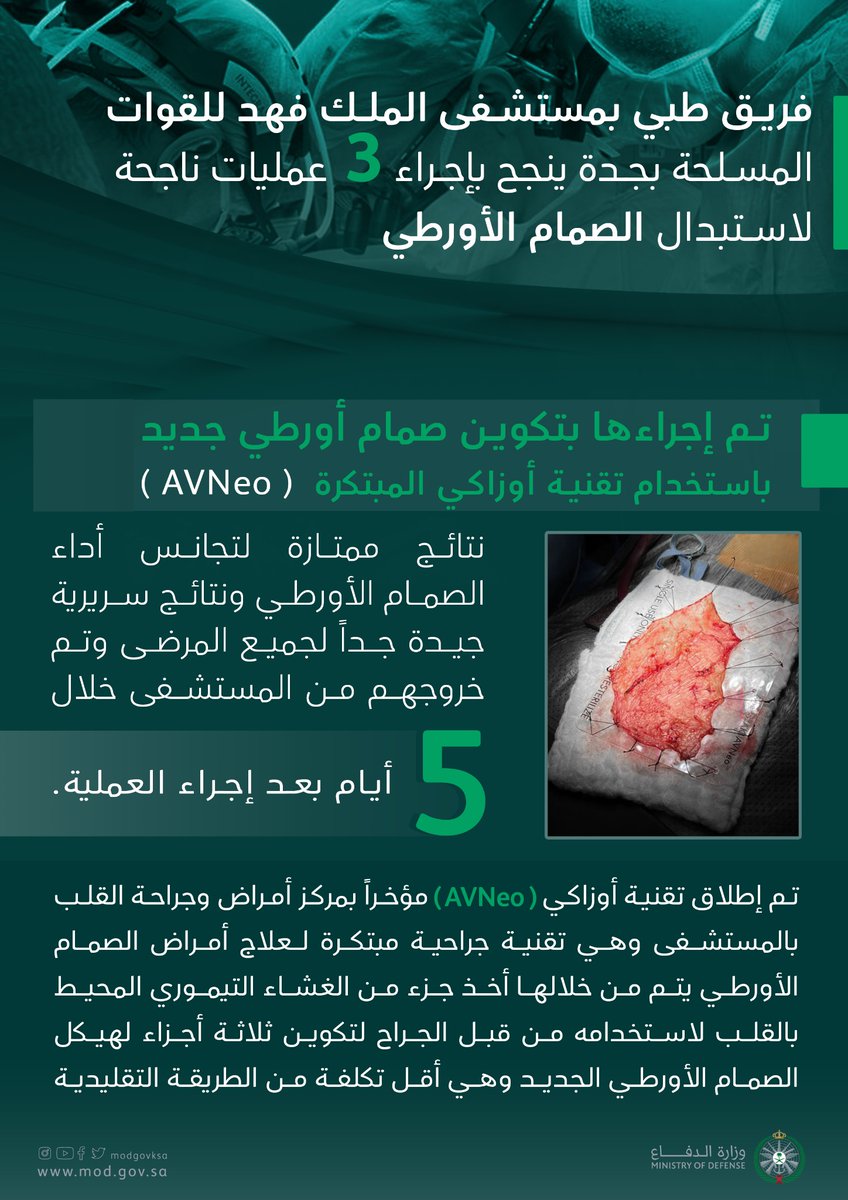 modgovksa's tweet photo. مستشفى الملك فهد لـ #القوات_المسلحة في جدة يجري 3 عمليات لاستبدال الصمام الأورطي، باستخدام تقنية جراحية حديثة. https://t.co/xdlWWlZzE6
