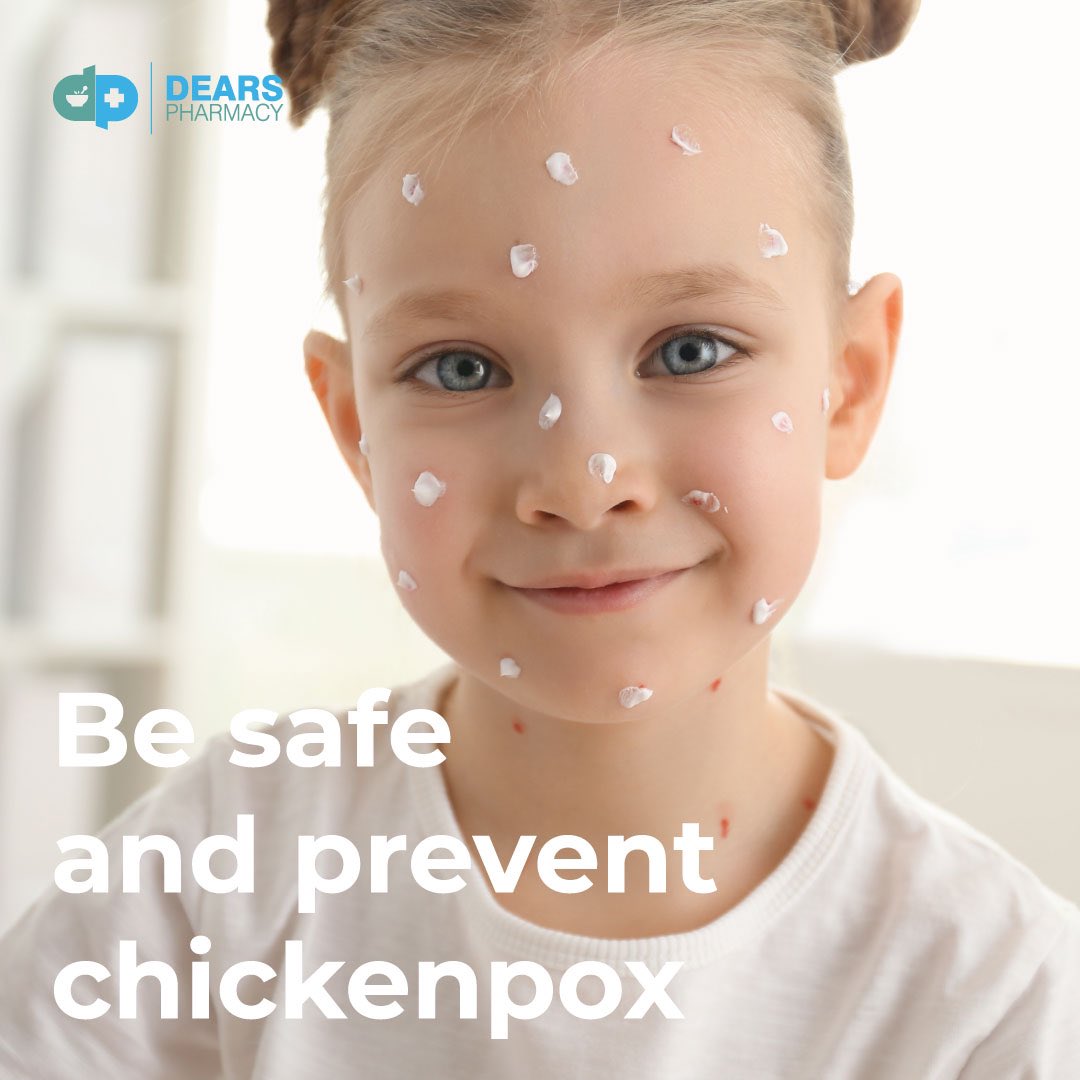 Protect against chicken pox. Vaccination service available across all our locations in Edinburgh, Fife &amp; Glasgow.  #chickenpox #edinburgh #fife #glasgow #mum #dad #parent