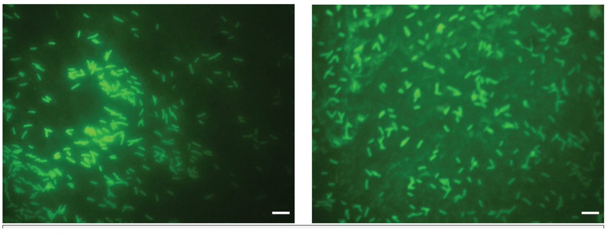 EurJBiol's tweet photo. 📢📢📢A paper published in the recent issue of European Journal of Biology “Serotyping of Legionella Bacteria Isolated from Various Water Systems in the Central Anatolia Region”

Read more: 

https://t.co/DRkIRHL4UJ
#eurjbiol #microbiology #science https://t.co/peJhueLmyy